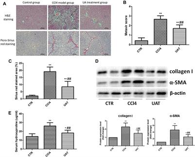 Protective Effect of Ursolic Acid on the Intestinal Mucosal Barrier in a Rat Model of Liver Fibrosis